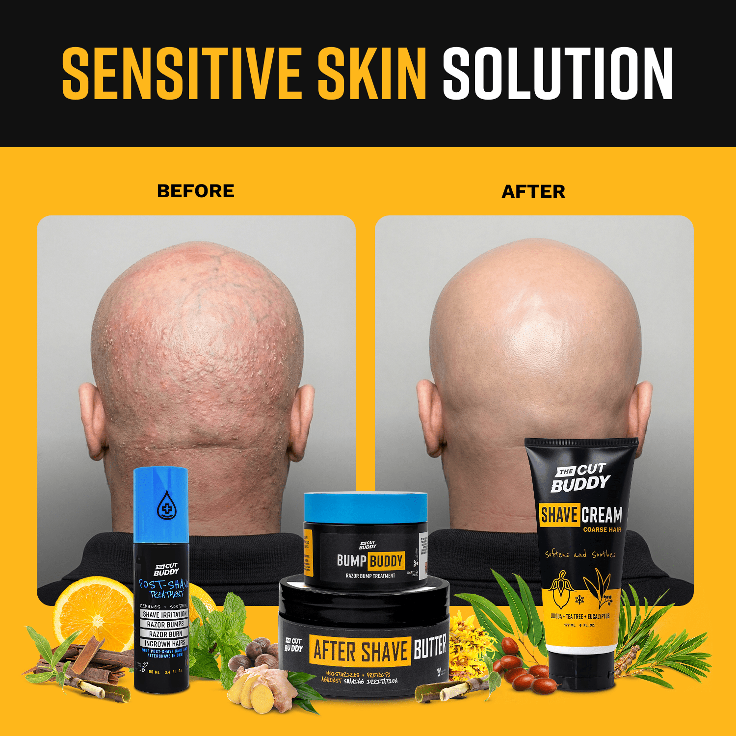 THE ZERO - BUMP SHAVE SYSTEM - The Cut Buddy - The Cut Buddy